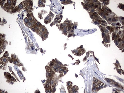 NME1 / NM23 Antibody (clone UMAB92, Carrier-free)