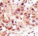 Polyclonal Rabbit anti-Human SENP5 Antibody (aa524-555, IHC, WB)