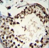 ASXL1 Antibody (aa521-549)