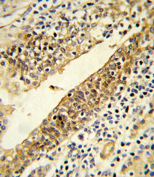 CYP51A1 / CYP51 Antibody (aa250-279)