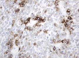 Monoclonal Mouse anti-Human ABCB1 / MDR1 / P Glycoprotein Antibody (clone OTI2C7, IHC, WB)