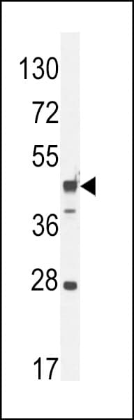 RILPL1 Antibody (aa337-366)