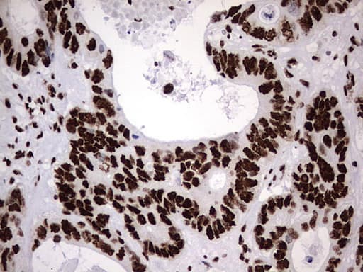 HNRPM / HNRNPM Antibody (aa1-261, clone OTI4C9)