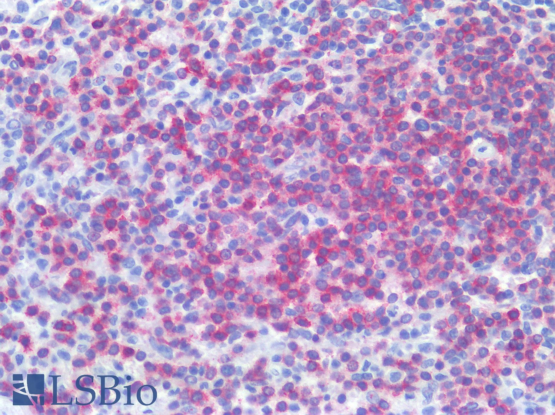 IHC-plus™ CD79A / CD79 Alpha Antibody (aa202-216, clone JCB117 + HM47/A9)