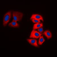TH / Tyrosine Hydroxylase Antibody (N-Terminus)