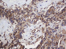 PAI-RBP1 / SERBP1 Antibody (clone OTI5G2)