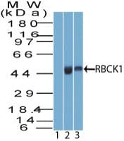 Polyclonal Rabbit anti-Human RBCK1 Antibody (aa150-200, WB)