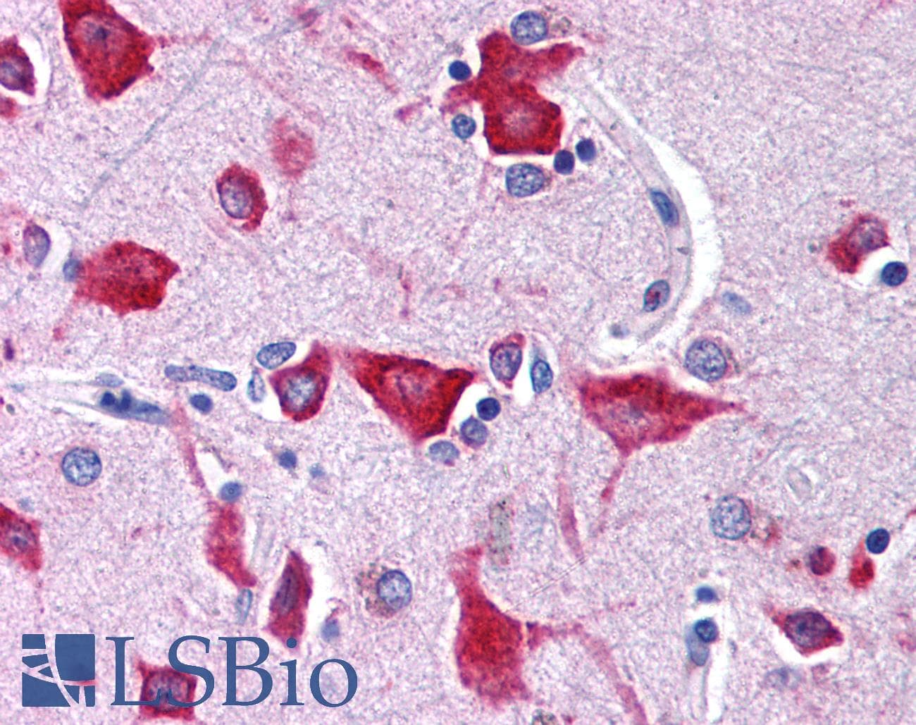 Polyclonal Rabbit anti-Human NMUR2 Antibody (N-Terminus, IHC, WB)