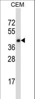 TRAIL-R4 / DCR2 Antibody (aa254-283)