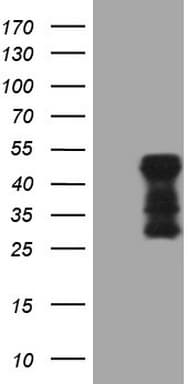 TARBP2 / TRBP2 Antibody (clone OTI7C1)