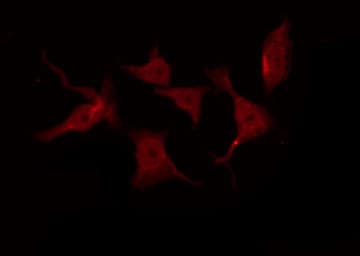 EGFR Antibody (phospho-Thr678)