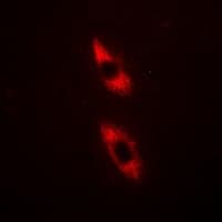 Polyclonal Rabbit anti-Human TRIM59 Antibody (IHC, IF, WB)