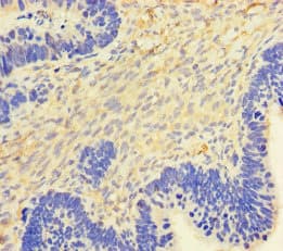 CSF2 / GM-CSF Antibody