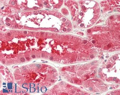 IHC-plus™ Monoclonal Mouse anti-Human TXN / Thioredoxin / TRX Antibody (clone 2A7, IHC, IF, WB)