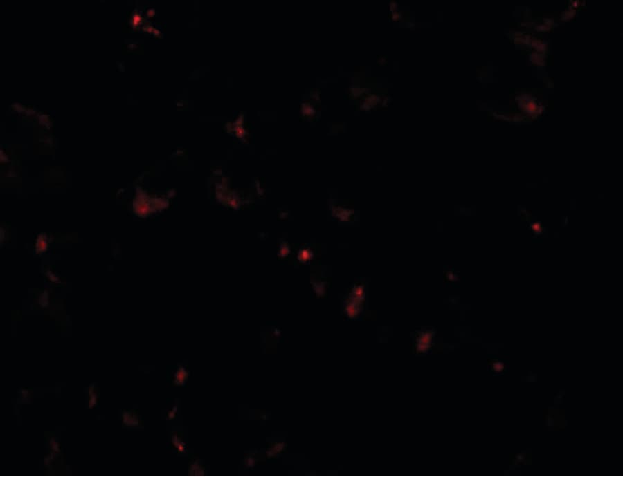 IHC-plus™ SIK2 / SNF1LK2 Antibody
