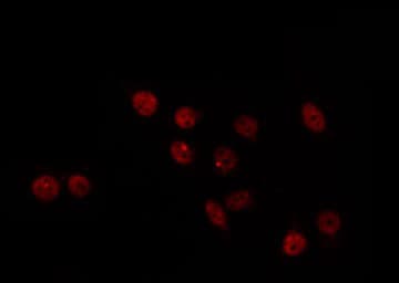 Polyclonal Rabbit anti-Human MED17 / TRAP80 Antibody (IF, WB)