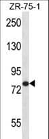 VG5Q / AGGF1 Antibody (aa61-90)