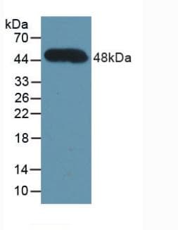 CFH / Complement Factor H Antibody (aa860-1231)
