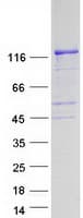 Human FGD1 Protein (Recombinant Myc-DDK (Flag))