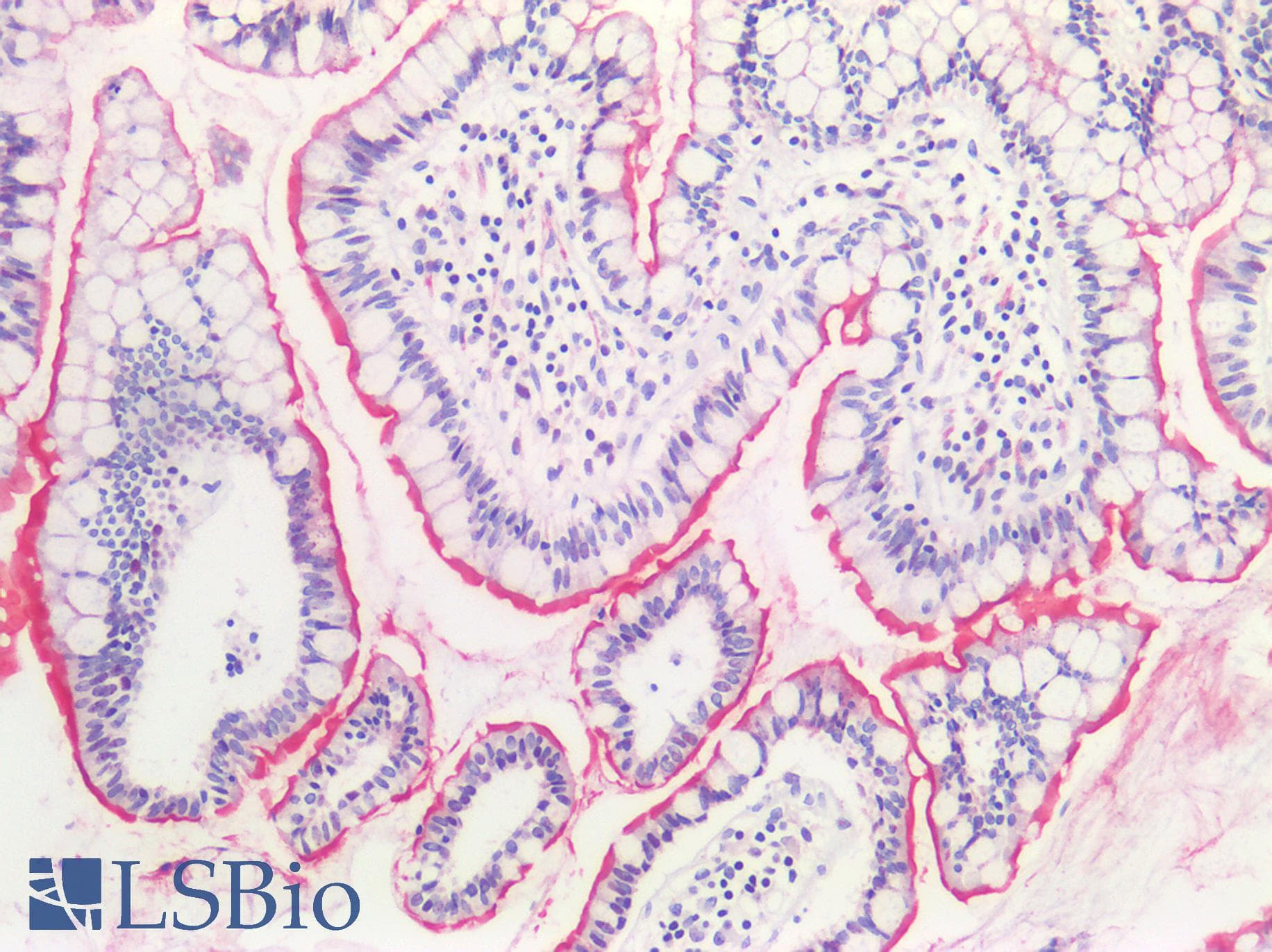 IHC-plus™ Polyclonal Rabbit anti-Human HTR1E / 5-HT1E Receptor Antibody (Cytoplasmic Domain, IHC)