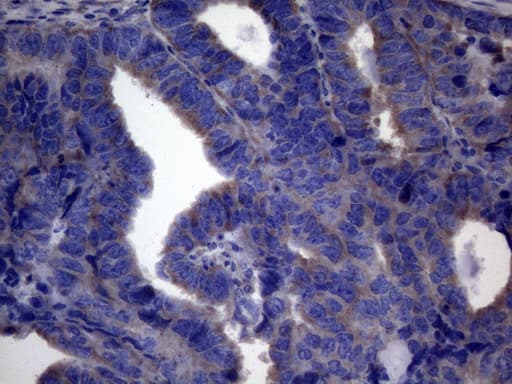 c-Kit / CD117 Antibody (aa27-308, clone OTI14B1)