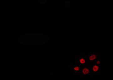 Polyclonal Rabbit anti-Human MEF2B Antibody (IF, WB)