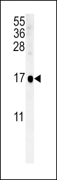 SIKE1 Antibody (aa154-182)