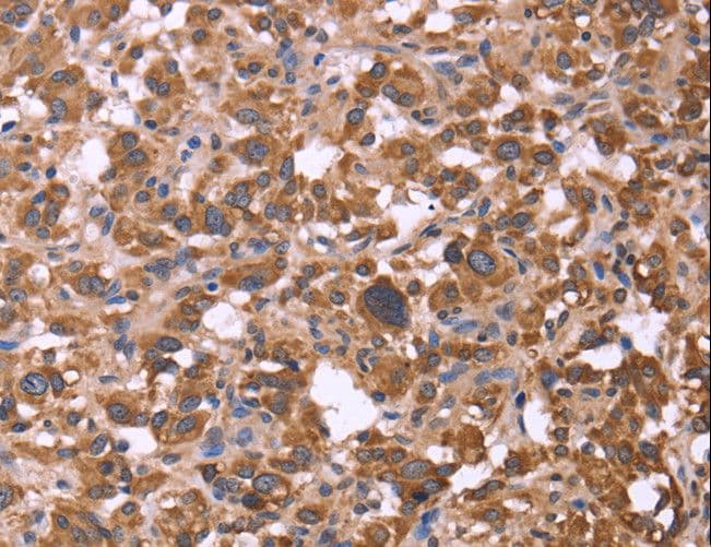 FBXW7 / FBW7 Antibody