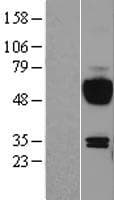 IL15RA Protein (Over-Expression Lysate Myc-DDK (Flag))