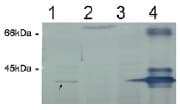 Polyclonal Rabbit anti-Human ER Alpha / Estrogen Receptor Antibody (Preservative Free, WB)