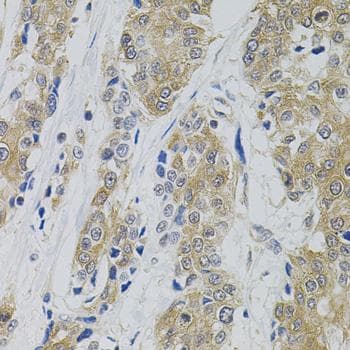 DNM2 / Dynamin-2 Antibody