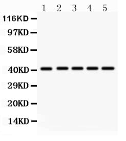 HOXA10 Antibody (aa57-340)