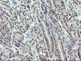 Monoclonal Mouse anti-Human ZBED1 / TRAMP Antibody (clone OTI2E5, IHC, WB)