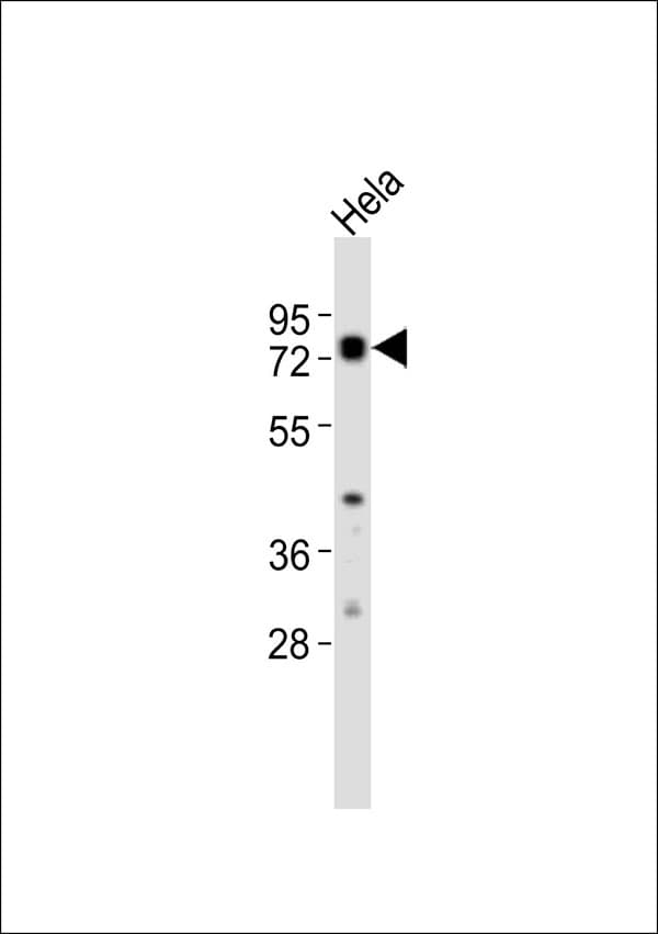 RDX / Radixin Antibody