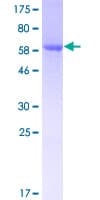Human CLUAP1 Protein (Recombinant GST)