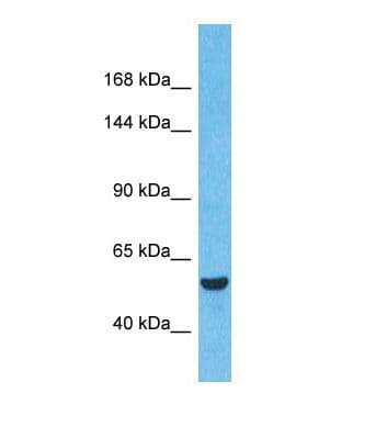 BRD3 Antibody (aa451-500)