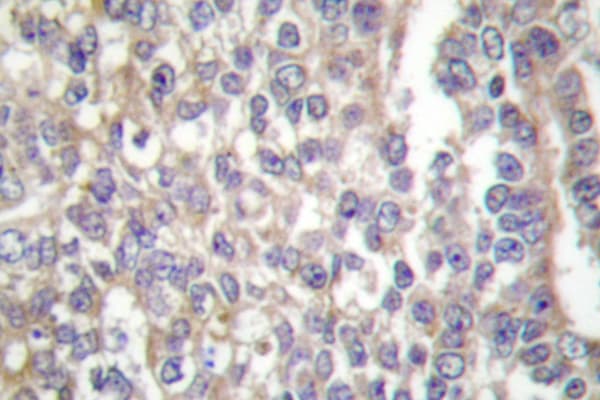 p66 / SHC Antibody (Glu343)