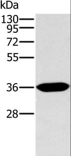 ITLN1 / Omentin Antibody