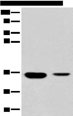 Polyclonal Rabbit anti-Human RGN / Regucalcin Antibody (IHC, WB)