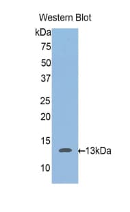 ACAN / Aggrecan Antibody (aa587-684, APC)