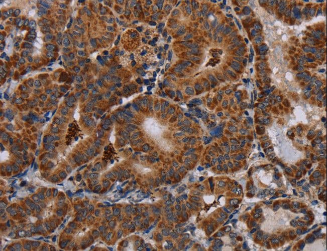 DISC1 Antibody
