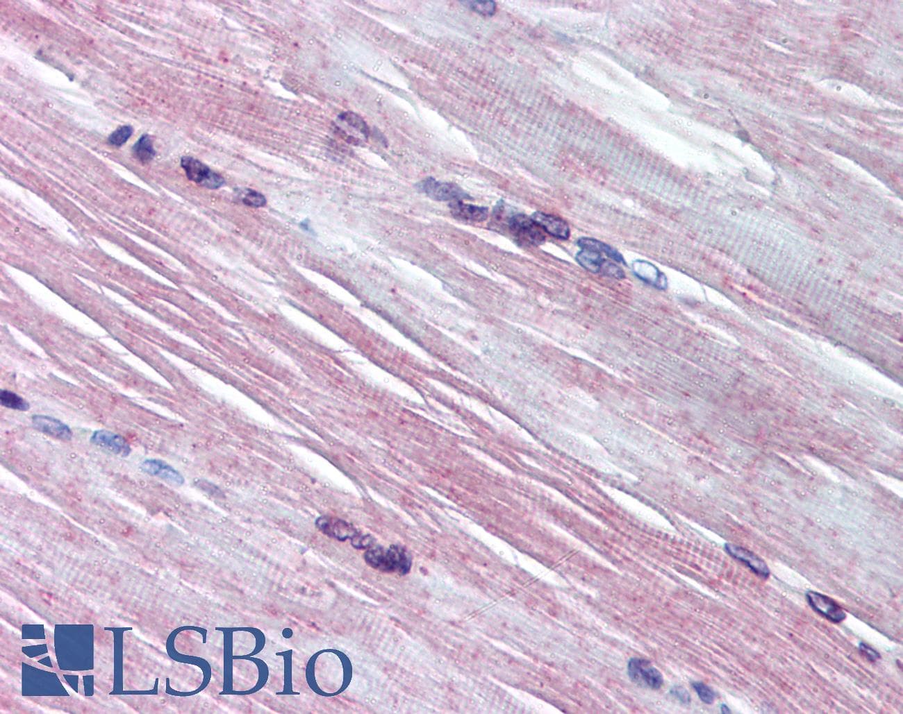 IHC-plus™ AMPD1 Antibody (aa140-190)