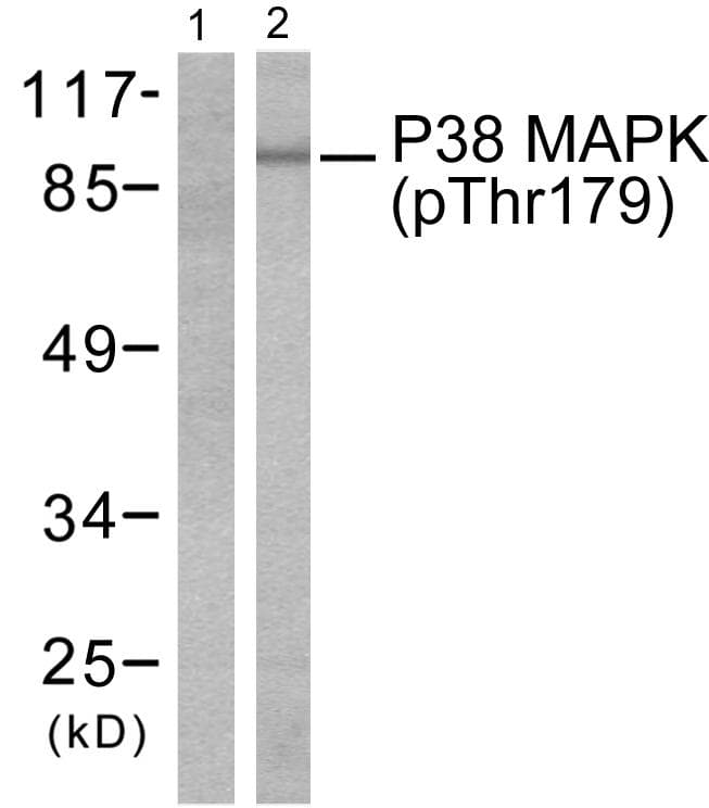 MAPK14 / p38 Antibody (phospho-Thr180)