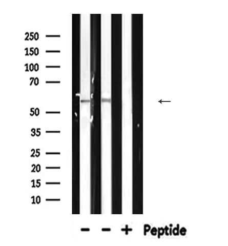NCF2 / NOXA2 / p67phox Antibody