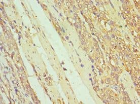IL7R / CD127 Antibody (aa21-239)