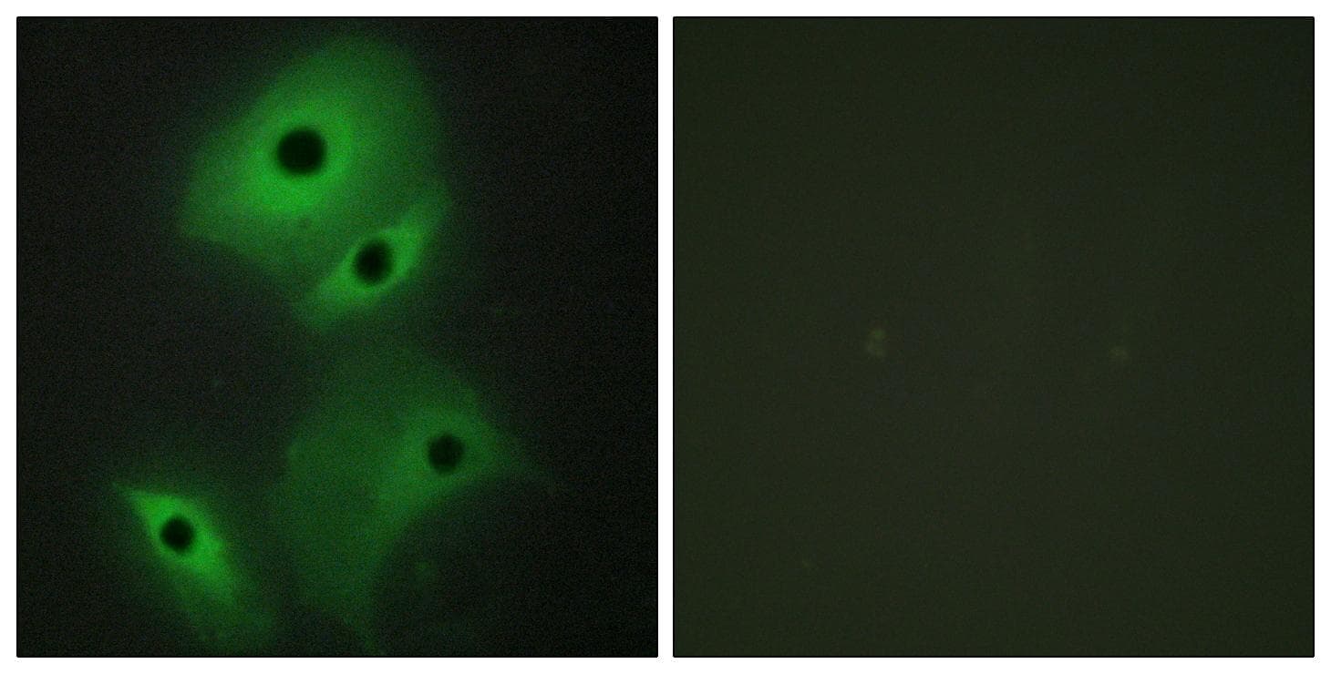 NBL1 / DAN Antibody