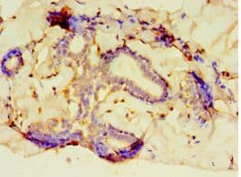 Polyclonal Rabbit anti-Human PCDHA6 Antibody (aa1-230, IHC)