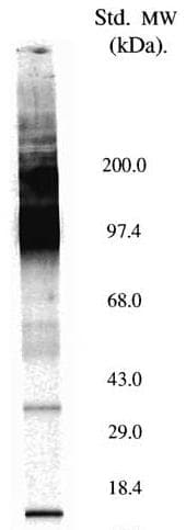 SLC5A5 / NIS Antibody (aa468-643, clone FP5)