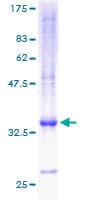 Human CXCL5 Protein (Recombinant GST)