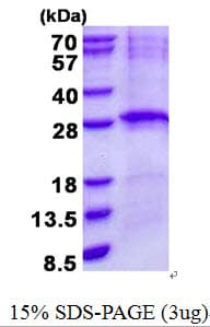 Human LIN7B Protein (Recombinant His)